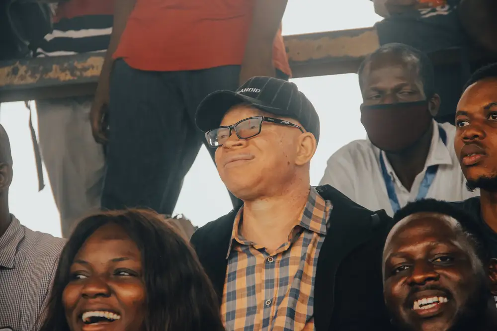 a smiling albino man
